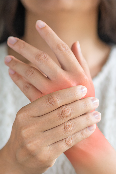 Arthritis